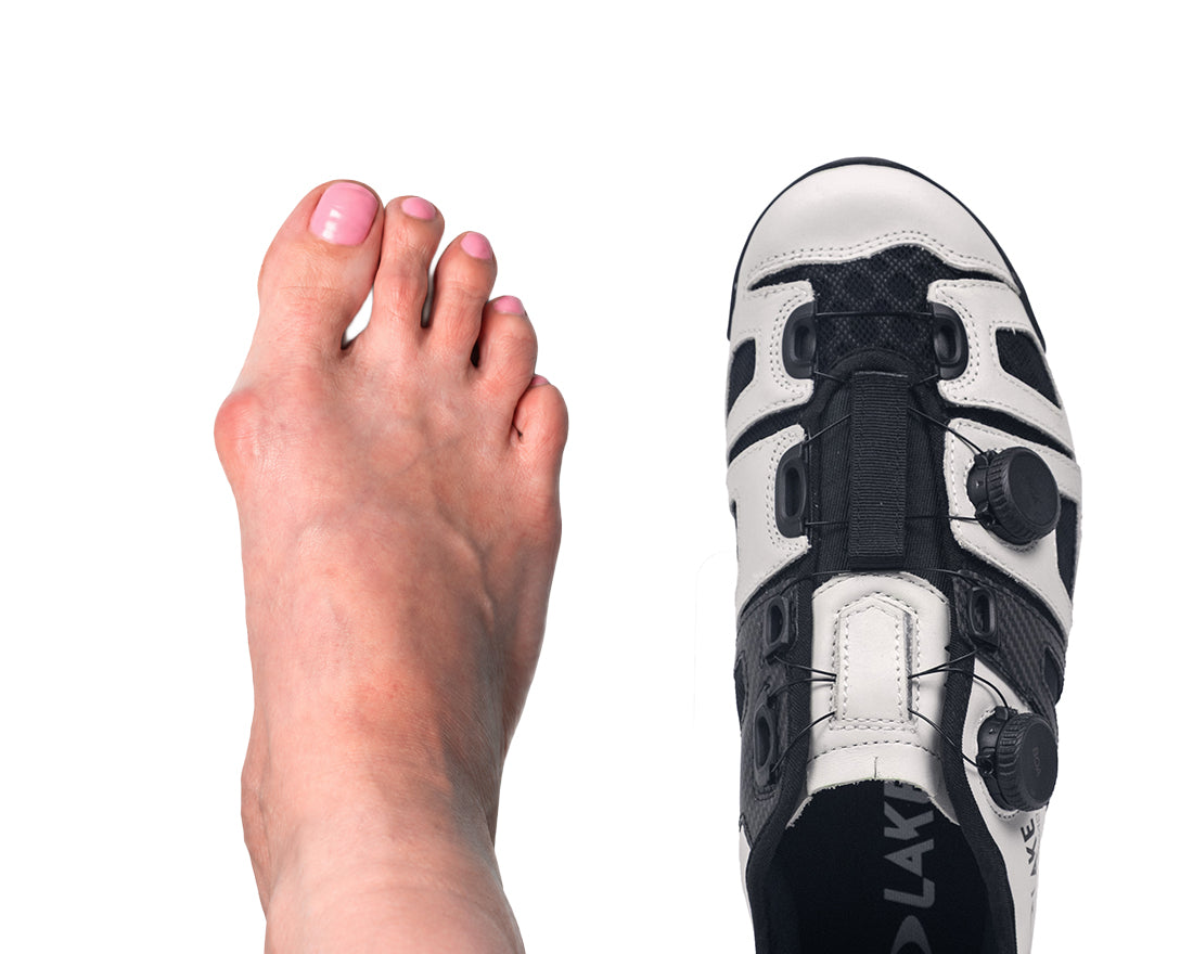 CX242 with hallux foot