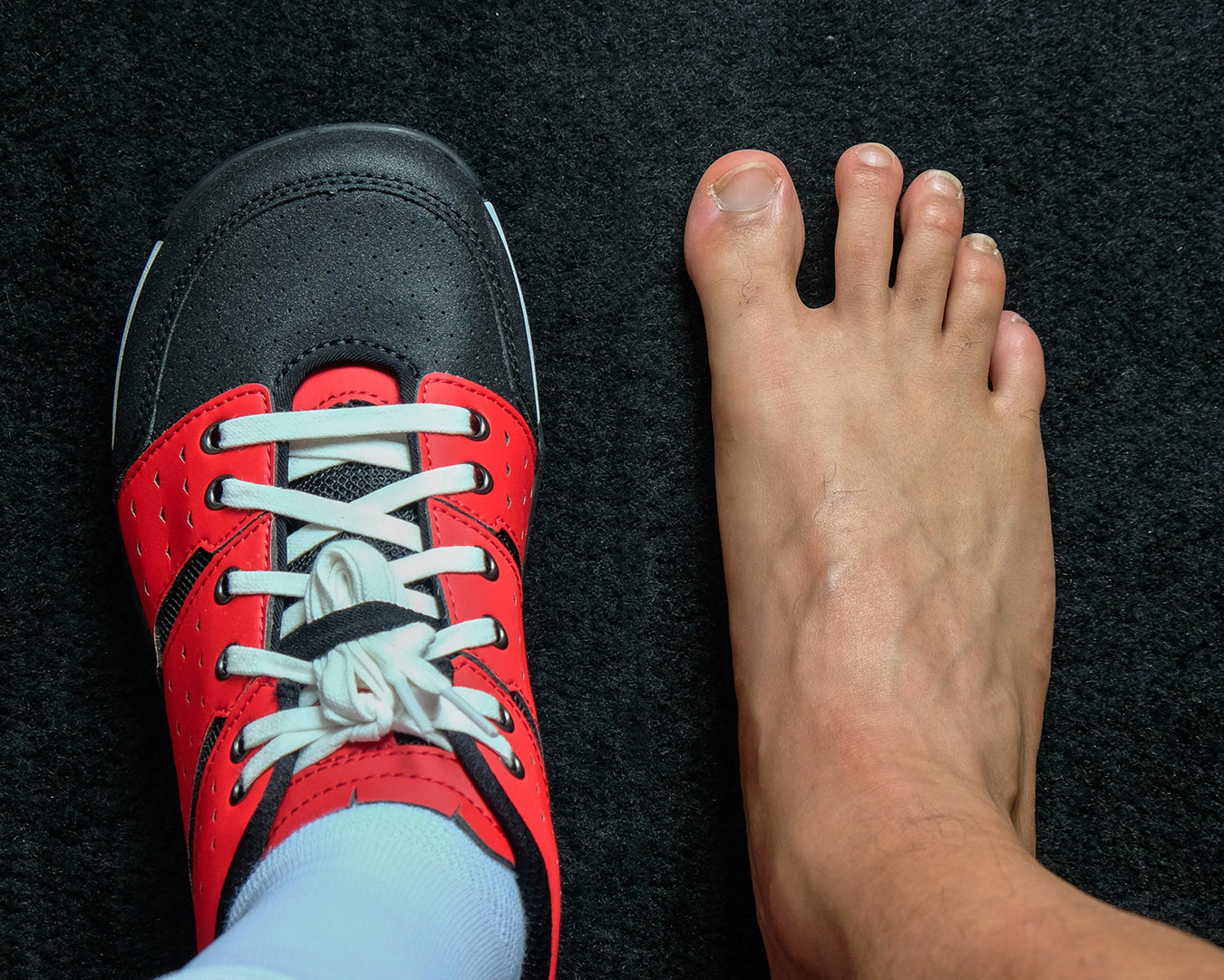 MX169 and Splayed toes
